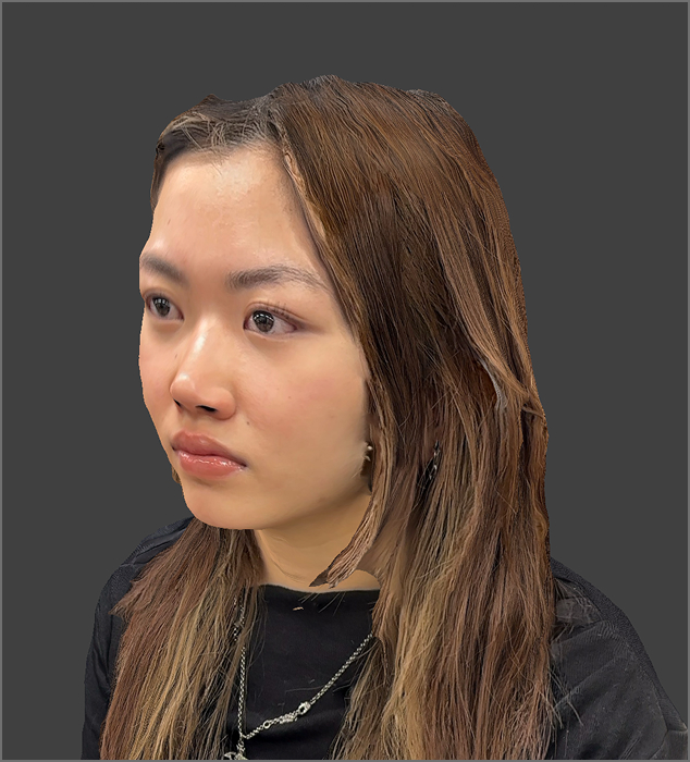 With my friend's help, I have a 3D scan of my own face. The texture of my hair is hard to capture, and there's a 'dent' in my head.
